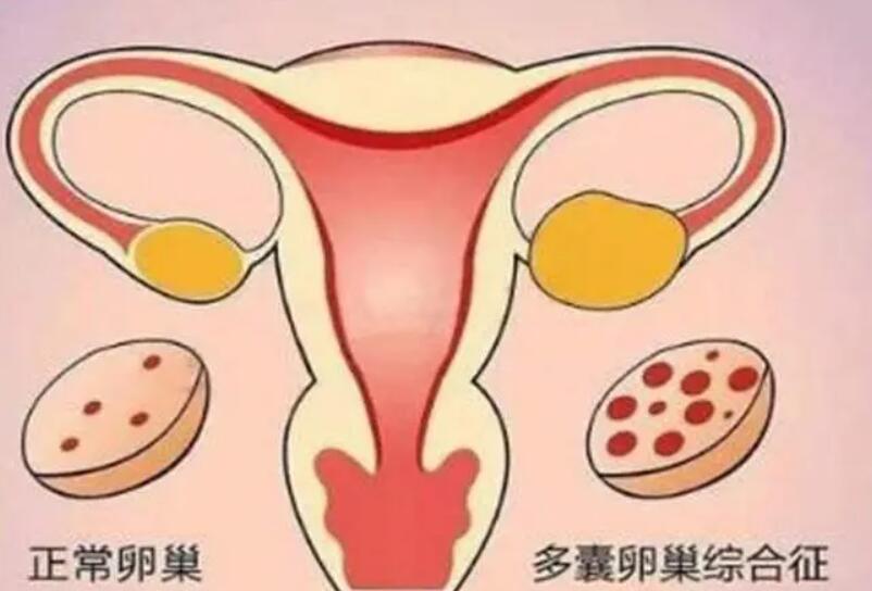 泰国试管婴儿哪家医院好?泰国做试管很厉害的医院排名一览!